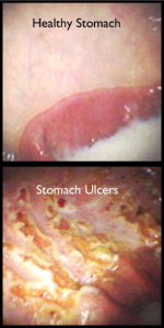 Equine stomach - ulcer comparison